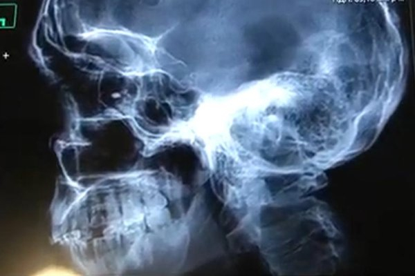 Dug in: Artillery shortage defines war for Ukraine's frontline soldiers Dug in: Artillery shortage defines war for Ukraine's frontline soldiers