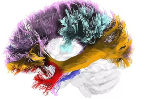 Racism produces brain changes that raise disease risk in Black populations Racism produces brain changes that raise disease risk in Black populations